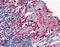 Myelin Basic Protein antibody, LS-B3315, Lifespan Biosciences, Immunohistochemistry paraffin image 