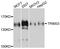 E3 ubiquitin-protein ligase TRIM33 antibody, STJ111828, St John