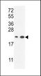 Abhydrolase Domain Containing 14B antibody, LS-C155882, Lifespan Biosciences, Western Blot image 