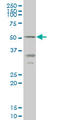 Ectonucleoside Triphosphate Diphosphohydrolase 5 (Inactive) antibody, LS-C196860, Lifespan Biosciences, Western Blot image 
