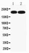 ATP Binding Cassette Subfamily A Member 3 antibody, PA2259, Boster Biological Technology, Western Blot image 