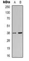 NDRG Family Member 4 antibody, orb319031, Biorbyt, Western Blot image 