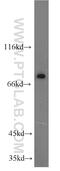 Potassium channel subfamily K member 5 antibody, 14136-1-AP, Proteintech Group, Western Blot image 