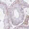 Ankyrin Repeat Domain 53 antibody, HPA049574, Atlas Antibodies, Immunohistochemistry frozen image 