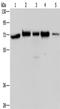 ArfGAP With FG Repeats 1 antibody, TA349455, Origene, Western Blot image 