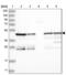 Protein phosphatase 1 regulatory subunit 7 antibody, NBP2-38207, Novus Biologicals, Western Blot image 