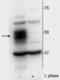 Myocyte Enhancer Factor 2C antibody, NBP2-60774, Novus Biologicals, Western Blot image 