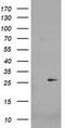 Cyclin Dependent Kinase Inhibitor 3 antibody, CF503582, Origene, Western Blot image 
