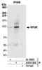 X-linked retinitis pigmentosa GTPase regulator antibody, A305-028A, Bethyl Labs, Immunoprecipitation image 