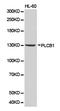 1-phosphatidylinositol-4,5-bisphosphate phosphodiesterase beta-1 antibody, LS-C193037, Lifespan Biosciences, Western Blot image 