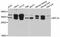 Ribosomal Protein L7a antibody, STJ27729, St John