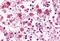 Adhesion G Protein-Coupled Receptor E2 antibody, MBS247833, MyBioSource, Immunohistochemistry frozen image 