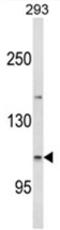 Espin antibody, AP18010PU-N, Origene, Western Blot image 