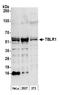 Transducin Beta Like 1 X-Linked Receptor 1 antibody, A300-408A, Bethyl Labs, Western Blot image 