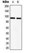 TLE Family Member 2, Transcriptional Corepressor antibody, LS-C354103, Lifespan Biosciences, Western Blot image 