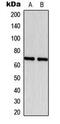 Estrogen Receptor 1 antibody, MBS8211893, MyBioSource, Western Blot image 