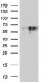 Amine oxidase [flavin-containing] A antibody, MA5-25861, Invitrogen Antibodies, Western Blot image 