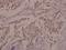 Cadherin 5 antibody, A02632Y731, Boster Biological Technology, Immunohistochemistry paraffin image 
