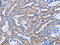 C-C chemokine receptor type 6 antibody, CSB-PA943255, Cusabio, Immunohistochemistry paraffin image 