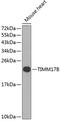 Mitochondrial import inner membrane translocase subunit Tim17-B antibody, GTX65540, GeneTex, Western Blot image 