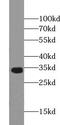 Vesicle-associated membrane protein-associated protein A antibody, FNab09369, FineTest, Western Blot image 