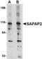 DLG Associated Protein 2 antibody, LS-B4593, Lifespan Biosciences, Western Blot image 