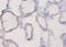 Plexin-A1 antibody, LS-C285732, Lifespan Biosciences, Immunohistochemistry paraffin image 