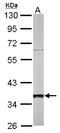 Small glutamine-rich tetratricopeptide repeat-containing protein alpha antibody, LS-C185412, Lifespan Biosciences, Western Blot image 