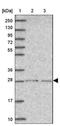 Speedy/RINGO Cell Cycle Regulator Family Member E2 antibody, NBP2-46794, Novus Biologicals, Western Blot image 
