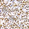 Histone Cluster 3 H3 antibody, A2359, ABclonal Technology, Immunohistochemistry paraffin image 