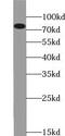 Zinc Finger DHHC-Type Containing 5 antibody, FNab09617, FineTest, Western Blot image 