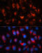 RAS Like Proto-Oncogene A antibody, 14-123, ProSci, Immunofluorescence image 