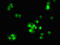 Pre-rRNA-processing protein TSR2 homolog antibody, LS-C679908, Lifespan Biosciences, Immunofluorescence image 