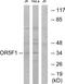 Olfactory Receptor Family 5 Subfamily F Member 1 antibody, PA5-39649, Invitrogen Antibodies, Western Blot image 