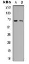 NADP-dependent malic enzyme, mitochondrial antibody, LS-C368905, Lifespan Biosciences, Western Blot image 