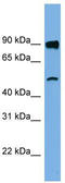 Family With Sequence Similarity 160 Member B1 antibody, TA344748, Origene, Western Blot image 
