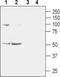 Cholinergic Receptor Nicotinic Alpha 2 Subunit antibody, TA328882, Origene, Western Blot image 
