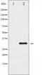 Heterogeneous Nuclear Ribonucleoprotein C (C1/C2) antibody, abx011946, Abbexa, Western Blot image 