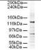 Adaptor Related Protein Complex 3 Subunit Delta 1 antibody, orb86585, Biorbyt, Immunohistochemistry paraffin image 