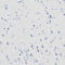 Desmocollin 2 antibody, HPA012615, Atlas Antibodies, Immunohistochemistry paraffin image 