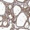 Erythrocyte Membrane Protein Band 4.1 Like 4A antibody, NBP1-81009, Novus Biologicals, Immunohistochemistry paraffin image 