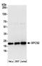 Signal Peptidase Complex Subunit 2 antibody, A305-608A-M, Bethyl Labs, Western Blot image 