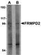 FERM And PDZ Domain Containing 2 antibody, orb75298, Biorbyt, Western Blot image 