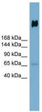 Salivary agglutinin antibody, TA346457, Origene, Western Blot image 