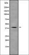 Homeobox protein Nkx-2.3 antibody, orb338384, Biorbyt, Western Blot image 