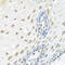 Zinc phosphodiesterase ELAC protein 2 antibody, abx005382, Abbexa, Western Blot image 