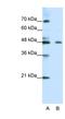 Zinc finger protein 645 antibody, NBP1-80163, Novus Biologicals, Western Blot image 