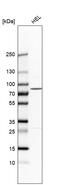 85 kDa calcium-independent phospholipase A2 antibody, HPA001171, Atlas Antibodies, Western Blot image 