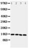 Somatostatin antibody, PA2054, Boster Biological Technology, Western Blot image 
