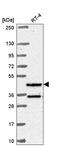 RFX Family Member 8, Lacking RFX DNA Binding Domain antibody, HPA059745, Atlas Antibodies, Western Blot image 